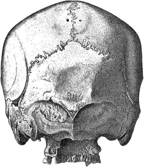 skull-head-cranium-bones-skeleton-8135246