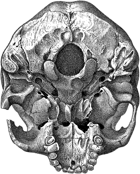skull-head-cranium-bones-skeleton-8135244