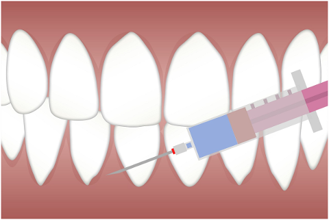anesthesia-dentist-tooth-teeth-4751564