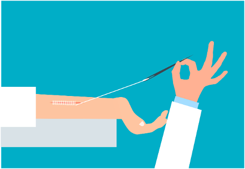 suture-surgery-wound-injury-scar-6934998